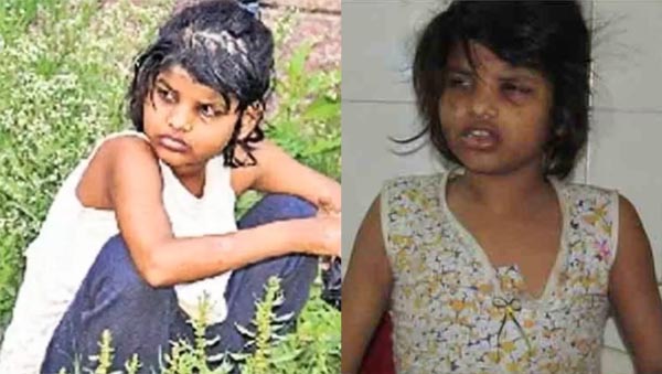 जंगल से मिली ‘मोगली गर्ल’ एहसास ने 18 साल की उम्र में दुनिया को कहा अलविदा