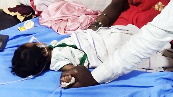 3 महीने के नवजात के पेट में था 8 हफ्ते का भ्रूण, डॉक्टरों ने सफलतापूर्वक बाहर निकाला